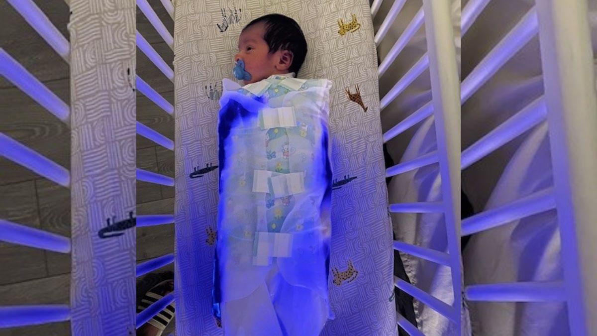 Home phototherapy service reaches 2,000-baby milestone